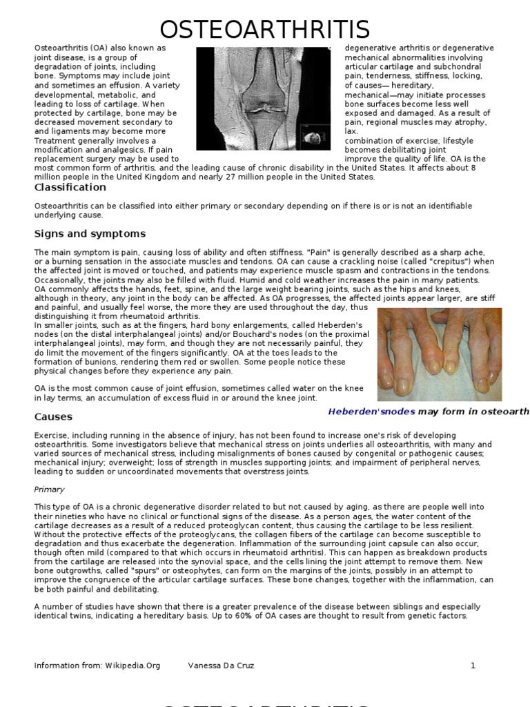Osteoarthritis Download Free Pdf Osteoarthritis Joint
