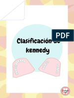 Clasificación de Kennedy