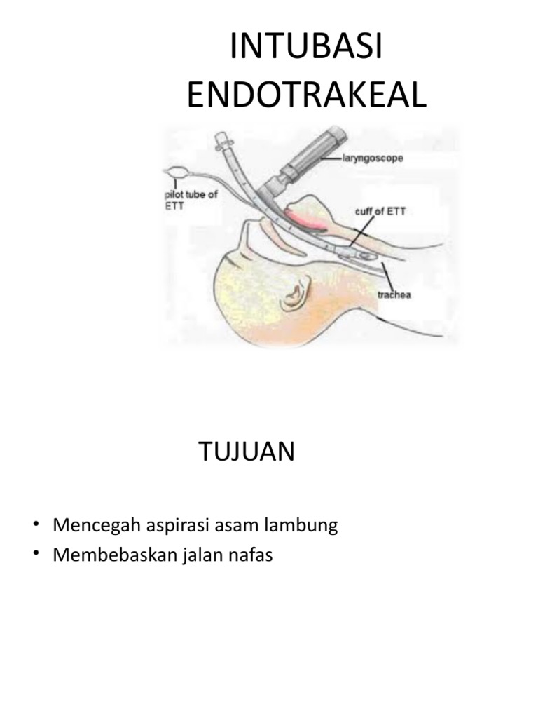 Pengenalan Endotracheal Tube | PDF