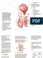 Vasectomy