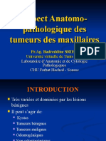 462879421-Aspect-Anatomo-pathologique-des-tumeurs-des-maxillaires-pptx