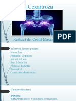 Tema:Coxartroza: Realizat De: Coadă Maxim