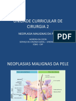 Neoplasias malignas da pele: carcinomas, melanoma e tratamentos