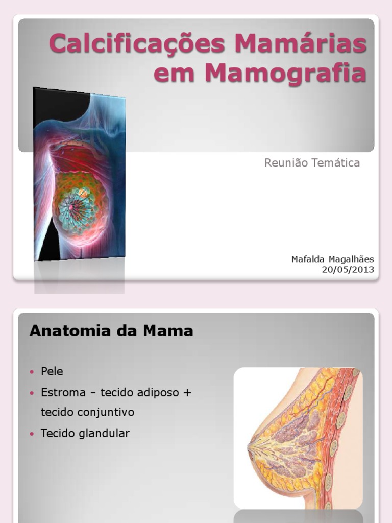 Calcificacoes Mamarias em Mamografia | PDF | Órgão (anatomia) | Causas ...
