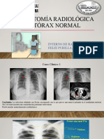 ANATOMÍA RADIOLÓGICA DEL TÓRAX NORMAL