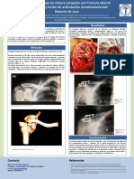 Poster Fractura Abierta Escapula Con Compromiso Acromioclavicular