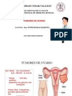 Tumor de Ovario