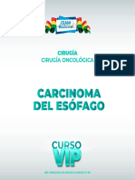 Carcinoma de Esofago