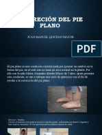 Correción Del Pie Plano