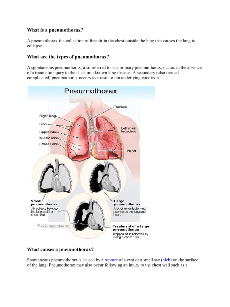 What Is A Pneumothorax | PDF | Mammography | Lung