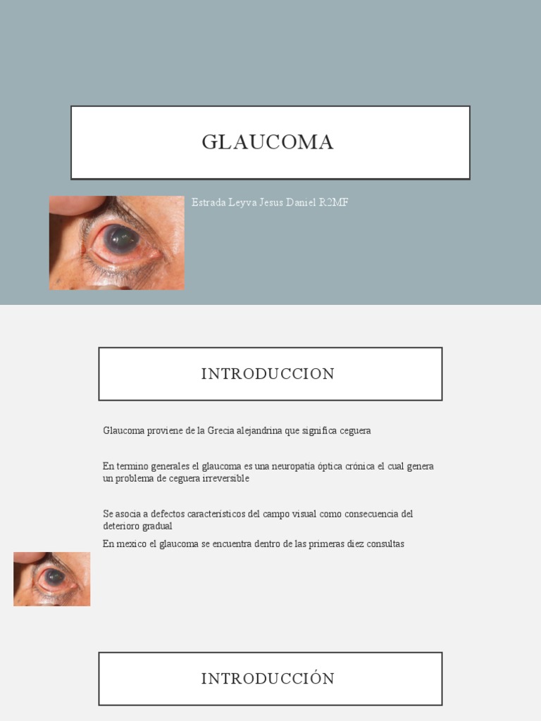 Glaucoma: Tipos, Diagnóstico y Tratamiento | PDF | Glaucoma | Catarata