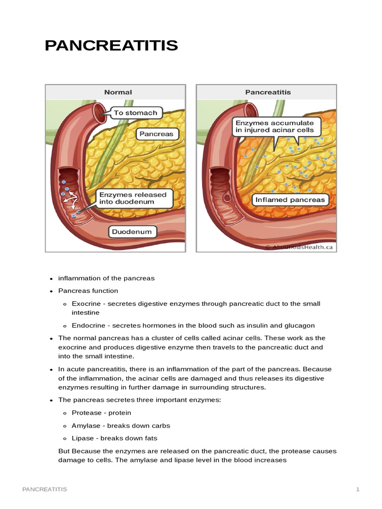 Pancreatitis | PDF | Pancreas | Anatomy