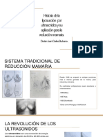 Historia de La Liposucción Por Ultrasonidos y Su Aplicación para La Reducción Mamaria