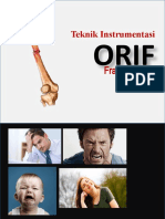 Instek ORIF Femur 2