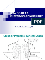 How To Read Electrocardiography: Ns. Devi Darliana, M.Kep., SP - MB