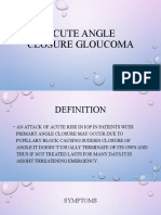 Acute Angle Closure Gloucoma