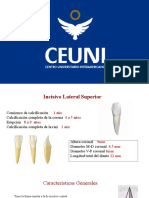 Incisivo Lateral Superior: Características Anatómicas y Clínicas