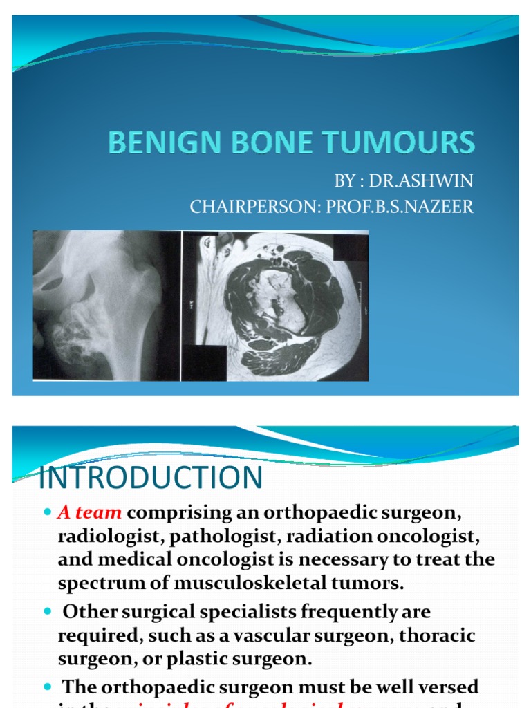 Benign Bone Tumours | PDF | Bone | Chemotherapy