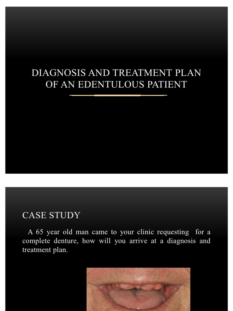 Diagnosis and Treatment Plan of an Edentulous Mouth Dentistry Dentures
