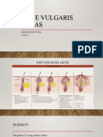 Akne Vulgaris Tugas