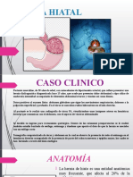 Hernia Hiatal