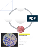 Dermatotifosis