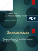 Electrocardiogramanormal