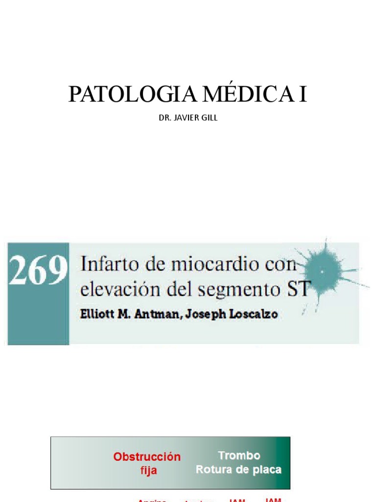 Diagnóstico y tratamiento del infarto agudo de miocardio | PDF ...