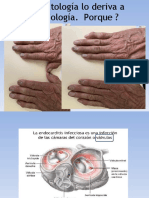 Endocarditis: causas, síntomas y tratamiento