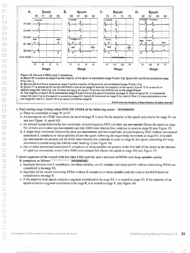 X Complex K Complex K Complea AASM Scoring Manual Version 2.5 31 PDF