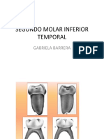 Segundo Molar Inferior Temporal