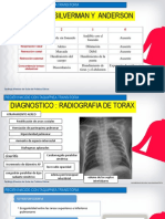 Recién Nacido Con Taquipnea Transitoria