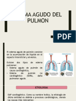 Edema Agudo de Pulmon