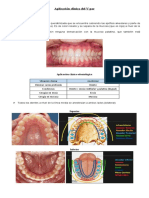 Anestesia dental para procedimientos en encía y mucosa