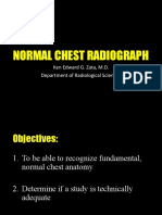 Normal Chest Radiograph REVISED