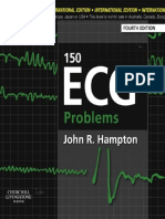 150 Ekg Vakası