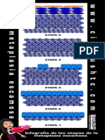 Infografía de Fases de la metaplasia escamosa