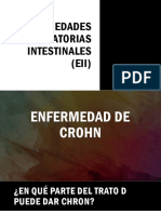 Enfermedad de Crohn