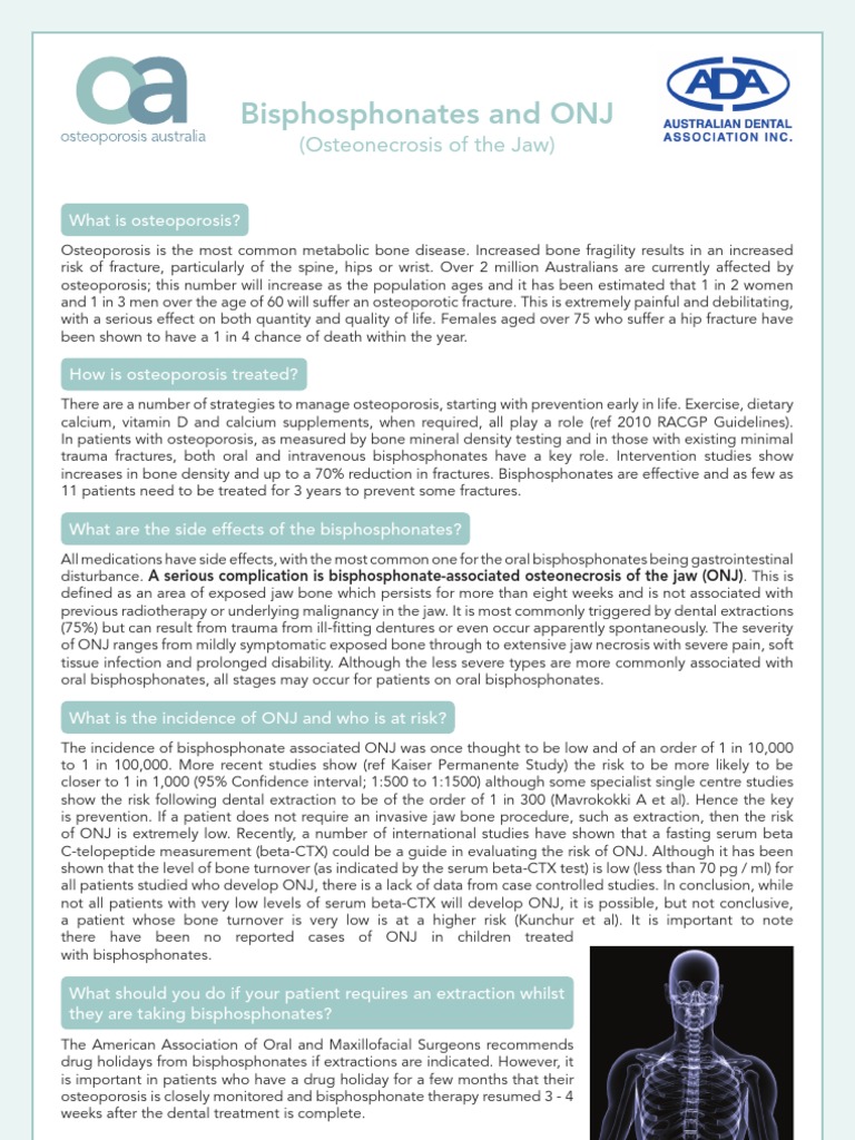 Osteoporosis and Teeth Extractions PDF Osteoporosis Dentistry