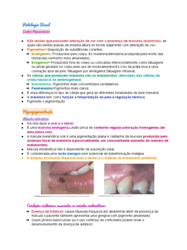 máculas melanóticas Máculas Melanóticas na Patologia Bucal | PDF | Neoplasmas