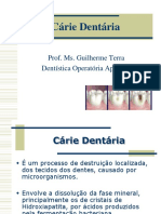 Cárie Dentária: Causas, Diagnóstico e Tratamento