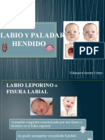 Labio y Paladar