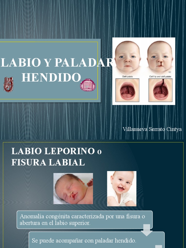 Labio y Paladar | PDF | Enfermedades y trastornos | Ciencias de la Salud