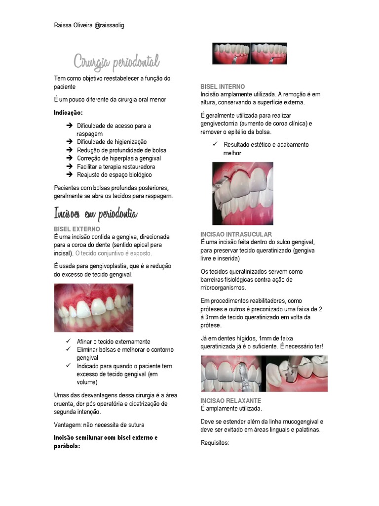 Incisões e Retalhos em Cirurgia Periodontal | PDF | Anatomia