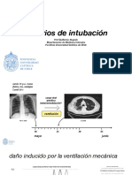 Criterios de Intubación