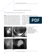 Pelvis Renal Bífida: Imágenes en Urología