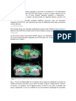 Radioterapia 3D