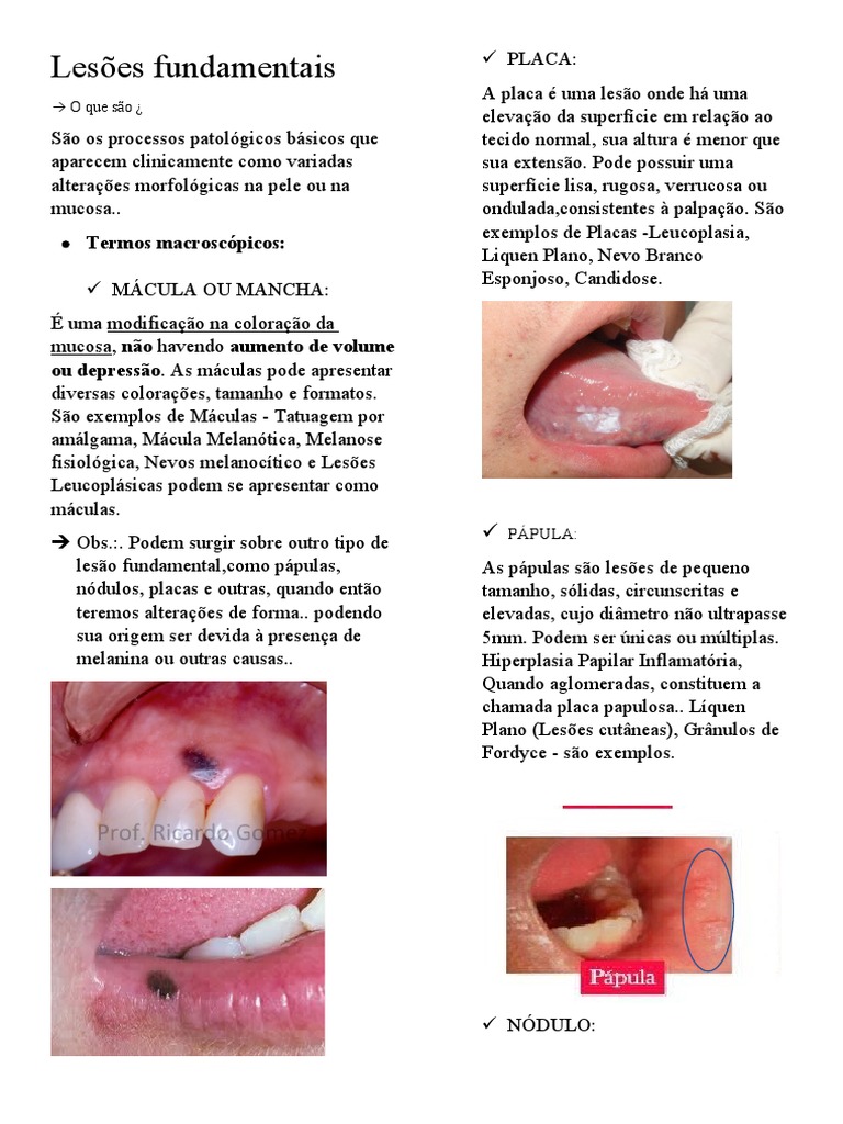 Lesões Fundamentais Resumo Pdf Epitélio Especialidades Médicas