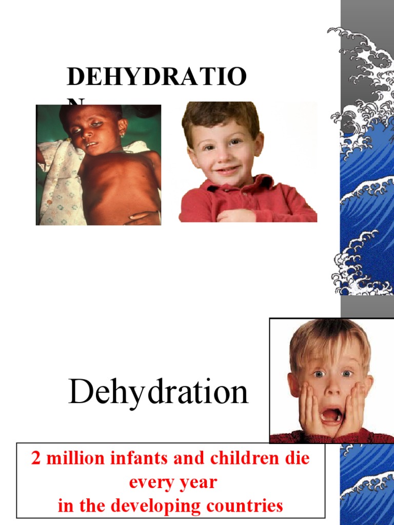 DEHYDRATION_4 PDF Dehydration Saline (Medicine)