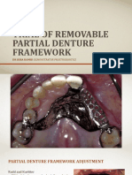Trial of Removable Partial Denture Framework